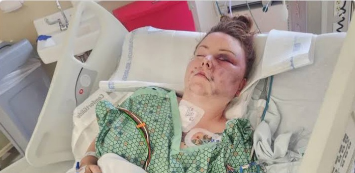 Woman stabbed, doused with gasoline and set on fire at home during fight with husband